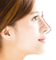 Nose Thread Lift Cost and Other FAQs About the Procedure